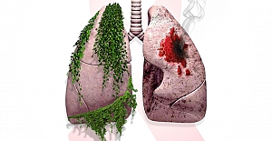 Akciğer kanserinden korunmak mümkün