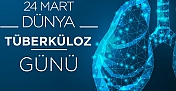 Kargı Devlet Hastanesi’nden tüberküloz uyarısı